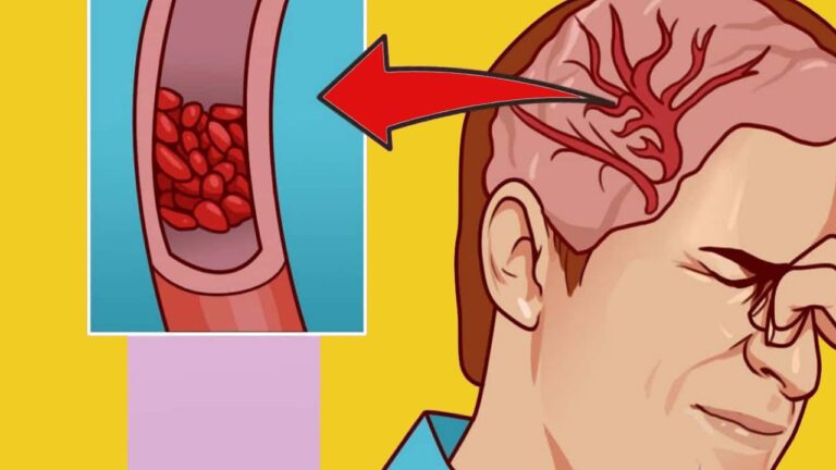 10 Anzeichen, dass dein Körper dringend Magnesium braucht – erkenne sie jetzt!