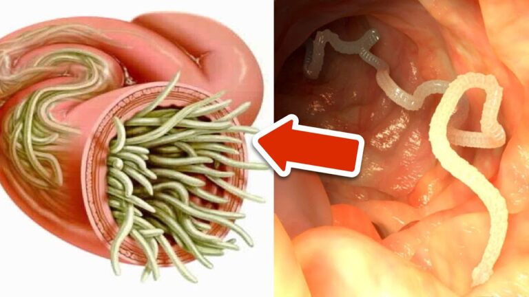7 Kräuter gegen innere Parasiten: Entdecke die 5 besten natürlichen Lösungen!