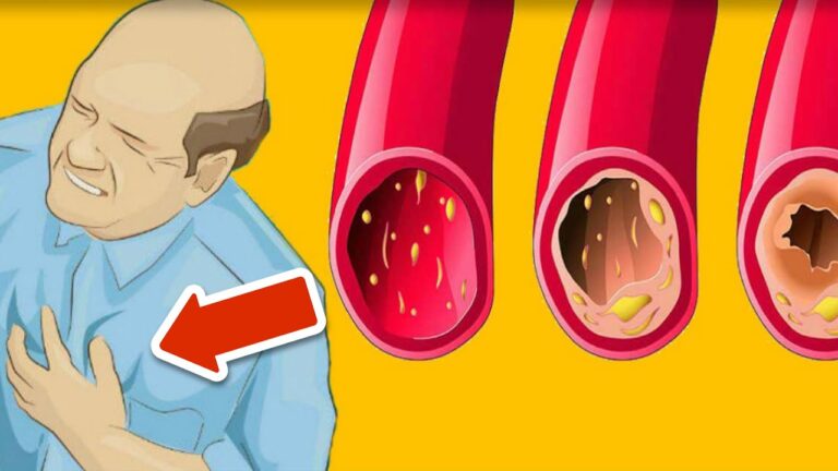 11 Lebensmittel zum Reinigen deiner Arterien – Entdecke die Wunderwirkung!