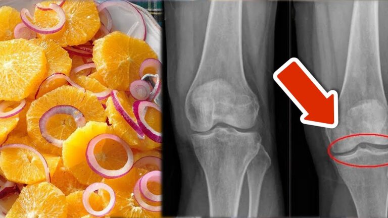 8 einfache Tipps für stärkere Knie: So schonst du Knorpel und Bänder ganz mühelos!