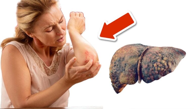 7 Anzeichen für eine kranke Leber an Haut und Beinen entdecken!