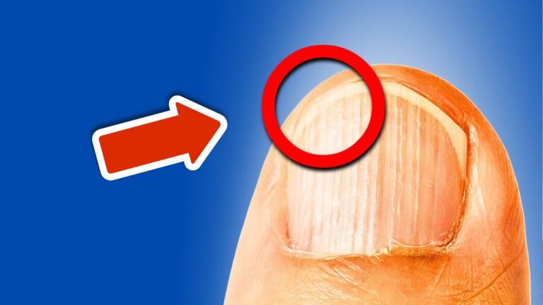 7 Warnzeichen, dass dein Körper dringend Nährstoffe braucht – entdecke sie jetzt!