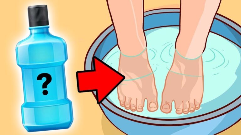 Verabschiede dich in 1 Schritt vom Nagelpilz – Die revolutionäre Methode!