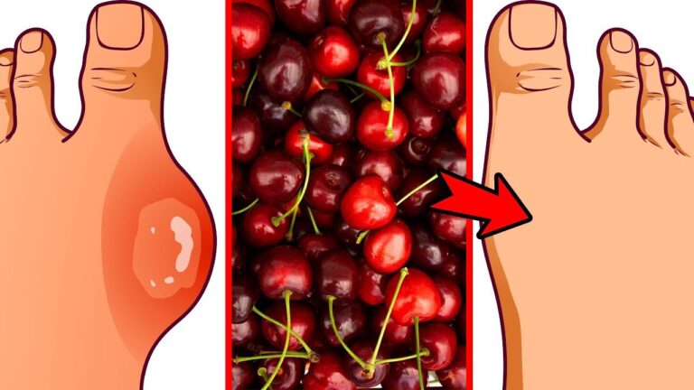 4 Gründe, warum Kirschen dein neuer Superfood-Held werden sollten!