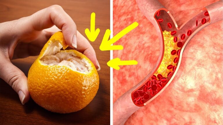 Senke deinen Cholesterinspiegel in nur 30 Tagen mit dieser überraschenden Methode!